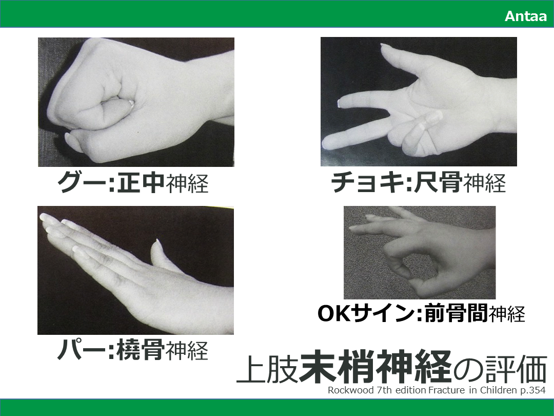 上肢末梢神経障害 L001.png