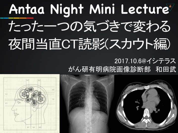 夜間当直CT読影の仕方！スカウトで迫る画像診断 L1.png