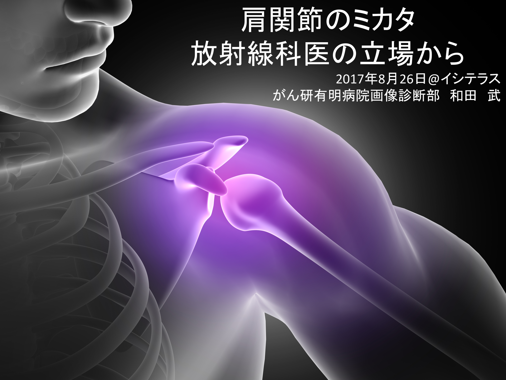 肩関節MRIのミカタ〜関節痛を放射線科医師の立場から診る〜 L1.png